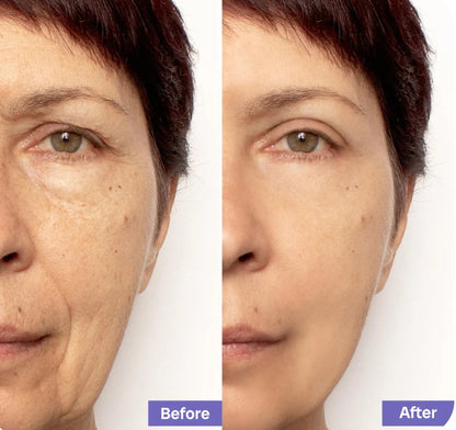 Bio-Collagen Mask